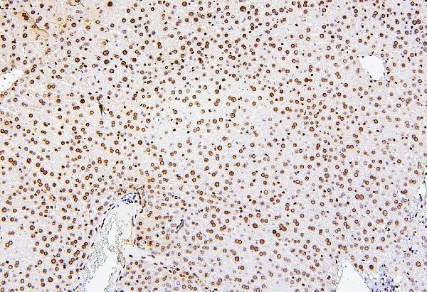 a08821 1 h1f0 primary antibodies ihc testing 2
