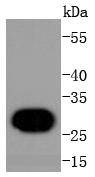 a08821 2 h1f0 primary antiboties wb testing 1