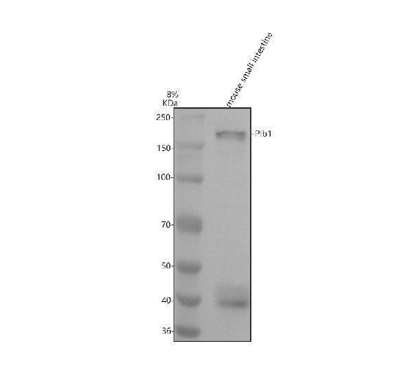 Western blot analysis of PLB1 using anti-PLB1 antibody (A08822-1)