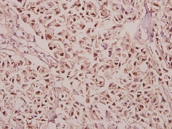 a08825 gabrg1 primary antiboties ihc testing 2