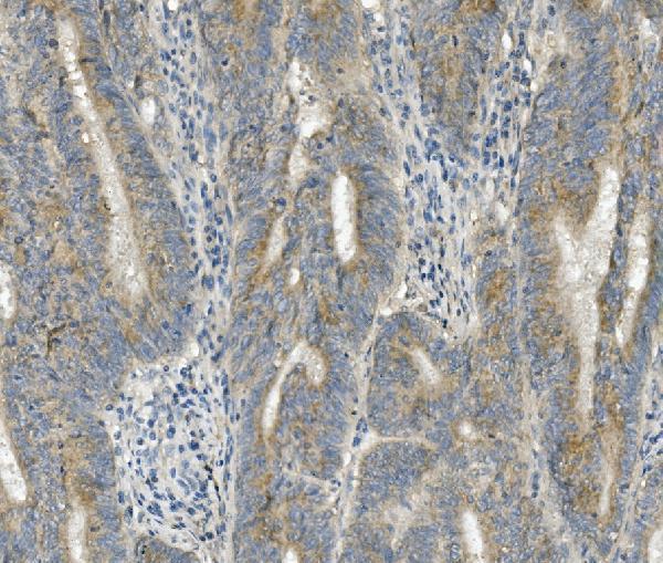 a08826 2 frmd6 primary antibodies ihc testing 2