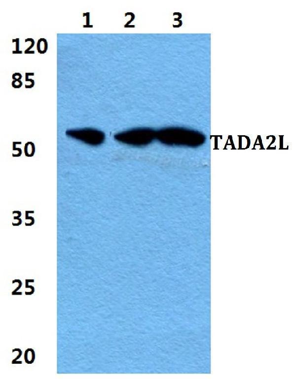 Western blot (WB) analysis of TADA2L polyclonal antibody at 1:500 dilution
Lane1:MCF-7 cell lysate
Lane2:sp2/0 cell lysate
Lane3:H9C2 cell lysate