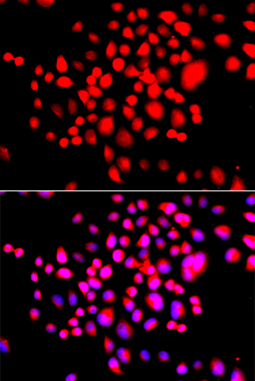 a08833 stk19 primary antiboties ihc testing 2