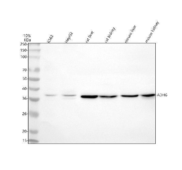  Western blot analysis of ADH6 using anti-ADH6 antibody (A08835-1)