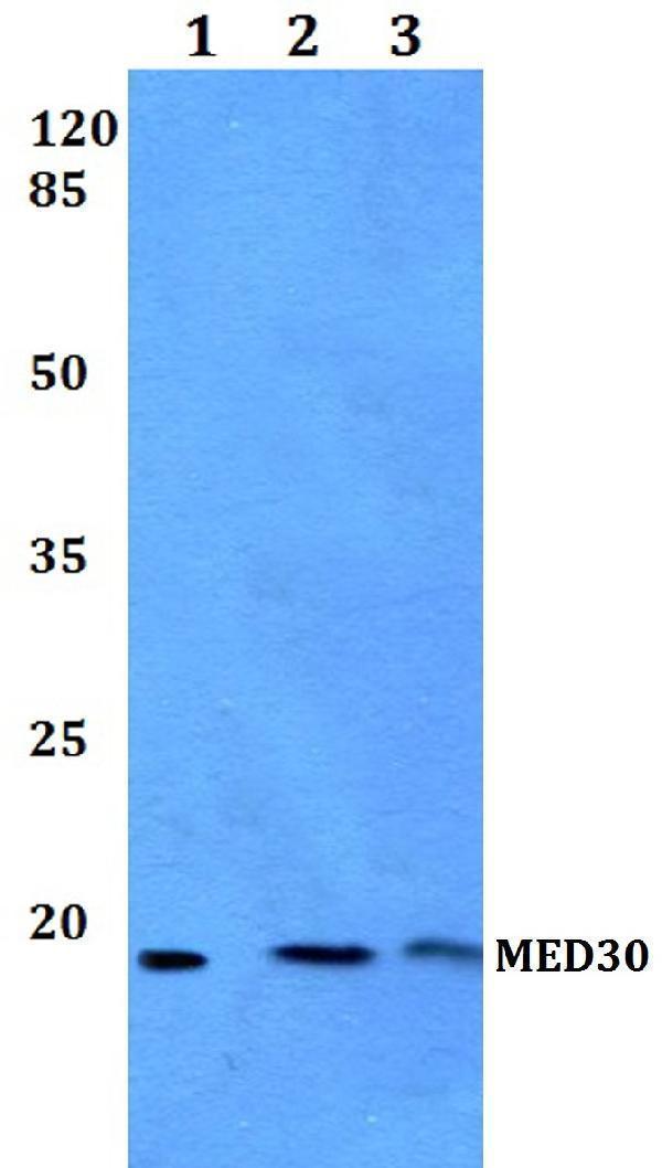 Western blot (WB) analysis of MED30 polyclonal antibody at 1:500 dilution
Lane1:HEK293T whole cell lysate
Lane2:Raw264