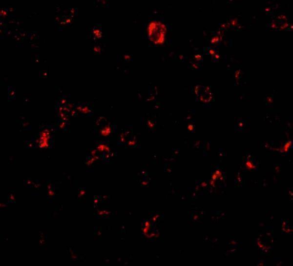 a08842 mtbp primary antibodies if testing 3