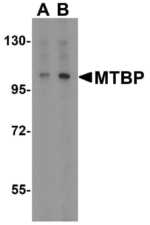 a08842 mtbp primary antibodies wb testing 1