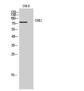 Western Blot analysis of COLO cells using CNK1 Polyclonal Antibody
