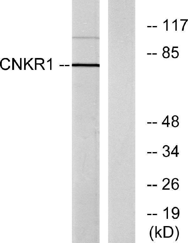 Western blot analysis of lysates from COLO205 cells, using CNKR1 Antibody