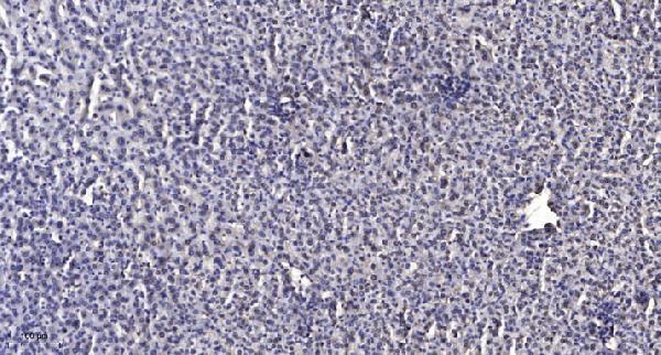 Immunohistochemical analysis of paraffin-embedded human liver cancer