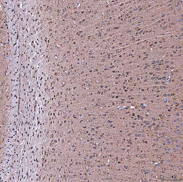 a08852 2 serac1 primary antibodies ihc testing 10
