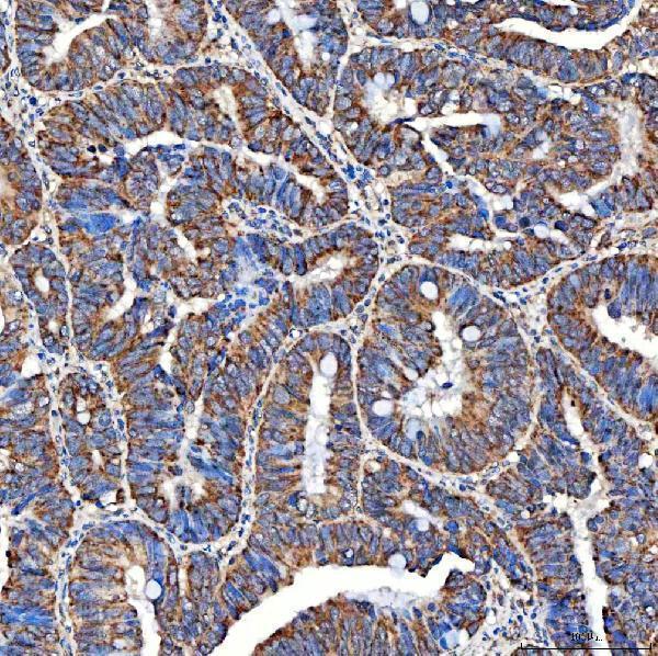 a08852 2 serac1 primary antibodies ihc testing 5