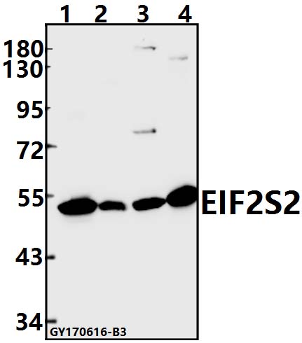 Western blot (WB) analysis of EIF2S2 polyclonal antibody at 1:500 dilution
Lane1:A549 whole cell lysate(40ug)
Lane2:CT26 whole cell lysate(40ug)
Lane3:C6 whole cell lysate(40ug)
Lane4:HEK293T whole cell lysate(40ug)