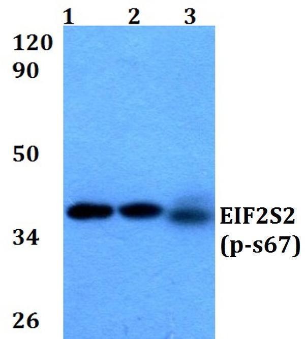 Western blot (WB) analysis of p-EIF2S2 (S67) polyclonal antibody at 1:500 dilution
Lane1:A549 whole cell lysate
Lane2:sp2/0 whole cell lysate 
Lane3:PC12 whole cell lysate 