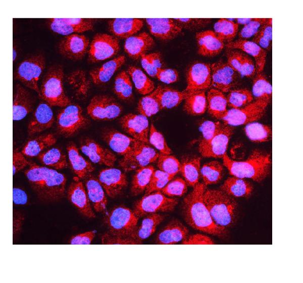 Figure 4. IF analysis of HOOK2 using anti-HOOK2 antibody (A08854-1). HOOK2 was detected in immunocytochemical section of A431 cells. Enzyme antigen retrieval was performed using IHC enzyme antigen retrieval reagent (AR0022) for 15 mins. The cells were blocked with 10% goat serum. And then incubated with 5microg/mL rabbit anti-HOOK2 Antibody (A08854-1) overnight at 4°C. DyLight?594 Conjugated Goat Anti-Rabbit IgG (BA1142) was used as secondary antibody at 1:100 dilution and incubated for 30 minutes at 37°C. The section was counterstained with DAPI. Visualize using a fluorescence microscope and filter sets appropriate for the label used.