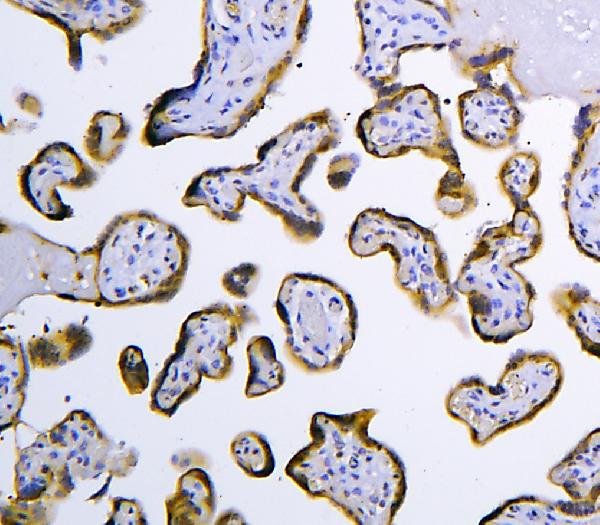 Figure 3. IHC analysis of HOOK2 using anti-HOOK2 antibody (A08854-1). HOOK2 was detected in a paraffin-embedded section of human placenta tissue. Heat mediated antigen retrieval was performed in EDTA buffer (pH 8.0, epitope retrieval solution). The tissue section was blocked with 10% goat serum. The tissue section was then incubated with 2 microg/ml rabbit anti-HOOK2 Antibody (A08854-1) overnight at 4°C. Peroxidase Conjugated Goat Anti-rabbit IgG was used as secondary antibody and incubated for 30 minutes at 37°C. The tissue section was developed using HRP Conjugated Rabbit IgG Super Vision Assay Kit (Catalog # SV0002) with DAB as the chromogen.