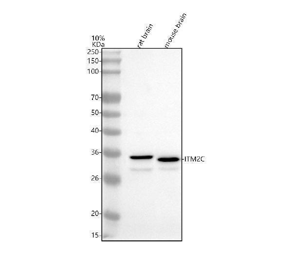  Western blot analysis of ITM2C using anti-ITM2C antibody (A08857-1)