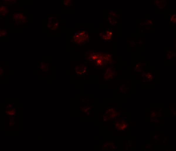 a08863 1 tshz2 primary antibodies if testing 2