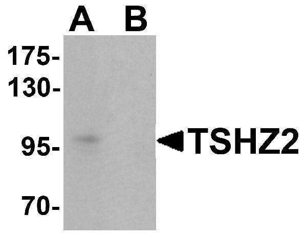 a08863 1 tshz2 primary antibodies wb testing 1