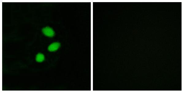 a08863 tshz2 primary antibodies if testing 1