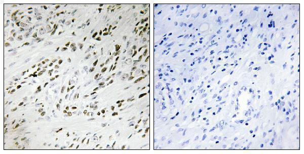 a08863 tshz2 primary antibodies ihc testing 2