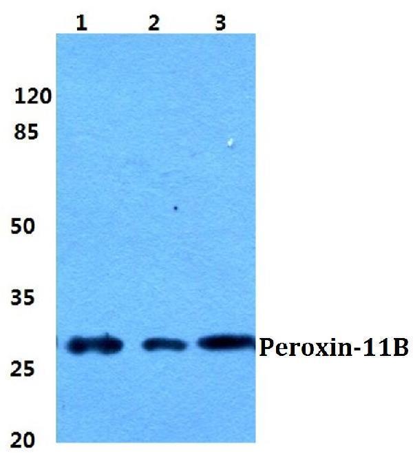 Western blot (WB) analysis of Peroxin-11B polyclonal antibody at 1:500 dilution
Lane1:MCF-7 cell lysate
Lane2:Raw264