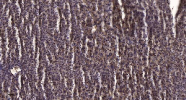 a08864 pex11b primary antibodies ihc testing 1