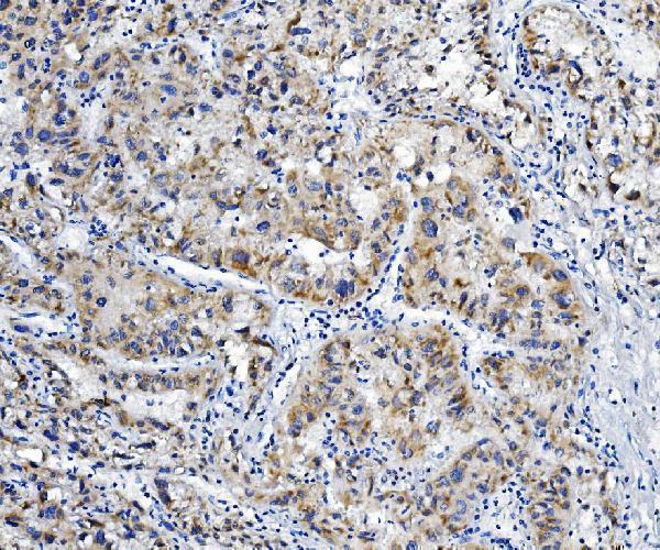 a08868 1 aldh6a1 primary antibodies ihc testing 2