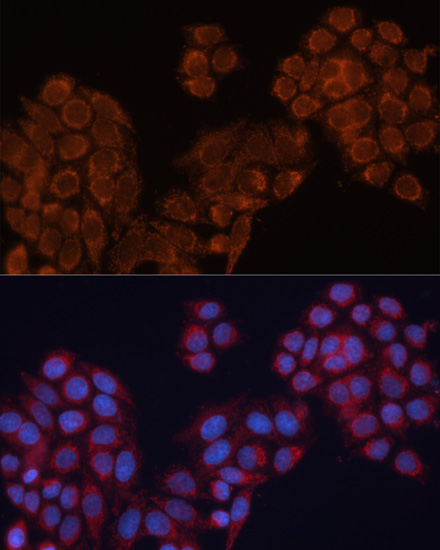 Immunofluorescence analysis of HeLa cells using ALDH6A1 antibody  at dilution of 1:100
