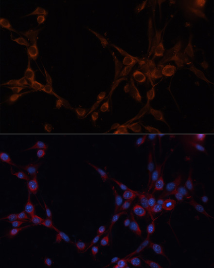 Immunofluorescence analysis of NIH/3T3 cells using ALDH6A1 antibody  at dilution of 1:100