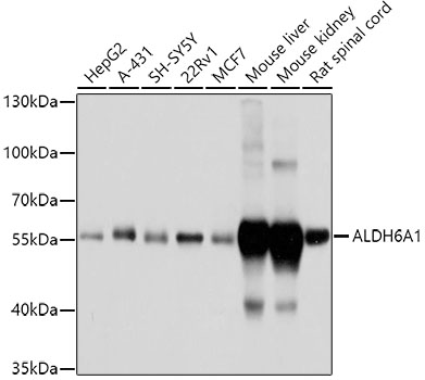 Western blot analysis of extracts of various cell lines, using ALDH6A1 antibody  at 1:1000 dilution
