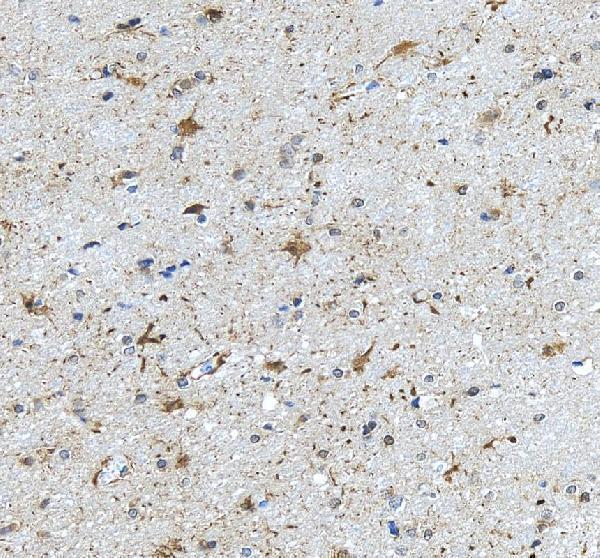 IHC analysis of ASRGL1 using anti-ASRGL1 antibody (A08869-1)