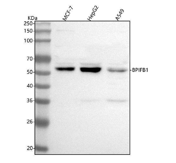  Western blot analysis of BPIFB1 using anti-BPIFB1 antibody (A08872-1)