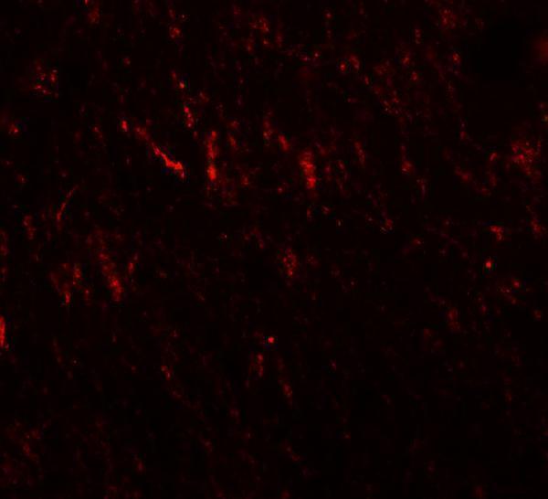 a08874 prickle2 primary antibodies if testing 2