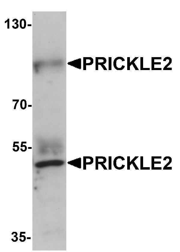 a08874 prickle2 primary antibodies wb testing 1