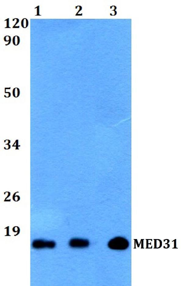 a08877 med31 primary antiboties wb testing 1