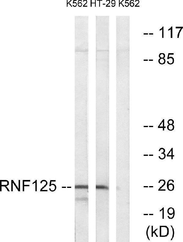 Western blot analysis of lysates from K562 and HT-29 cells, using RNF125 Antibody