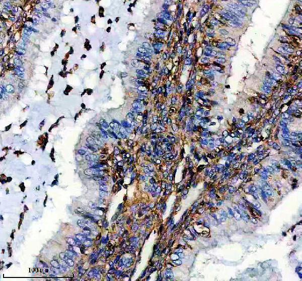 a08879 emilin2 primary antibodies ihc testing 1