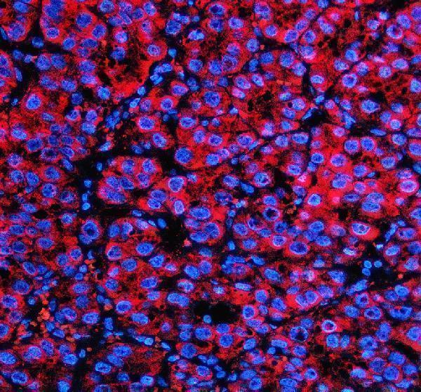 a08880 2 opn5 primary antibodies if testing 1