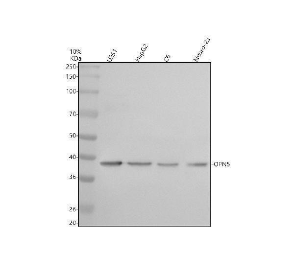 Western blot analysis of OPN5 using anti-OPN5 antibody (A08880-2)