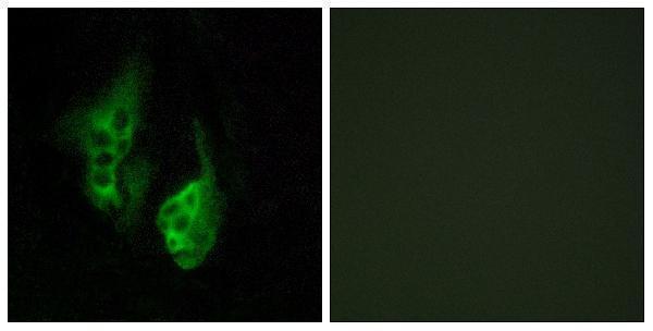 Immunofluorescence analysis of HeLa cells, using OPN5 Antibody