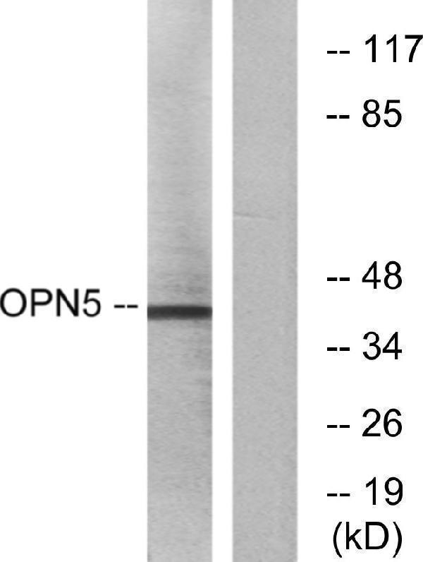 Western blot analysis of lysates from Jurkat cells, using OPN5 Antibody