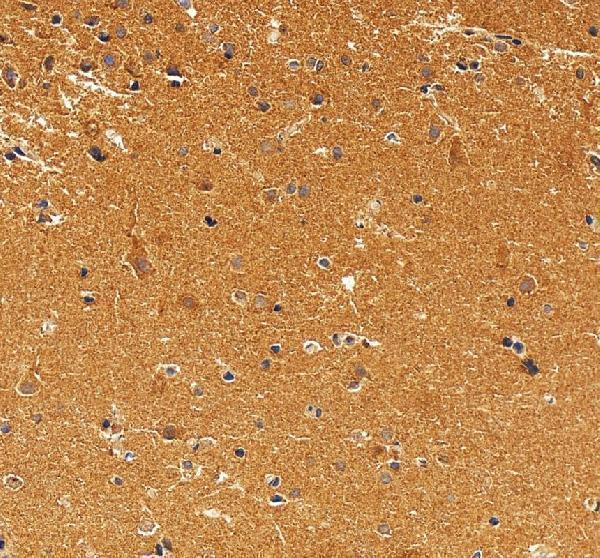 IHC analysis of Syntaphilin/SNPH using anti-Syntaphilin/SNPH antibody (A08882-1)