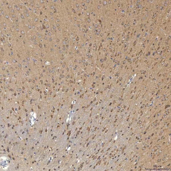  IHC analysis of SNPH using anti-SNPH antibody (A08882-1)