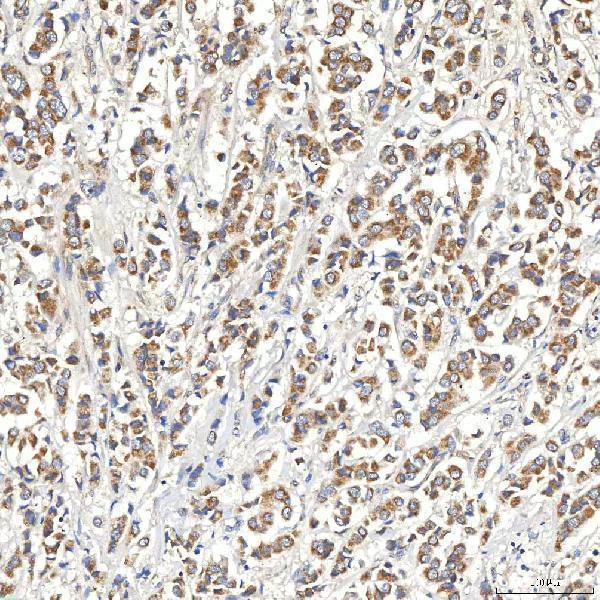 a08882 1 snph primary antibodies ihc testing 3