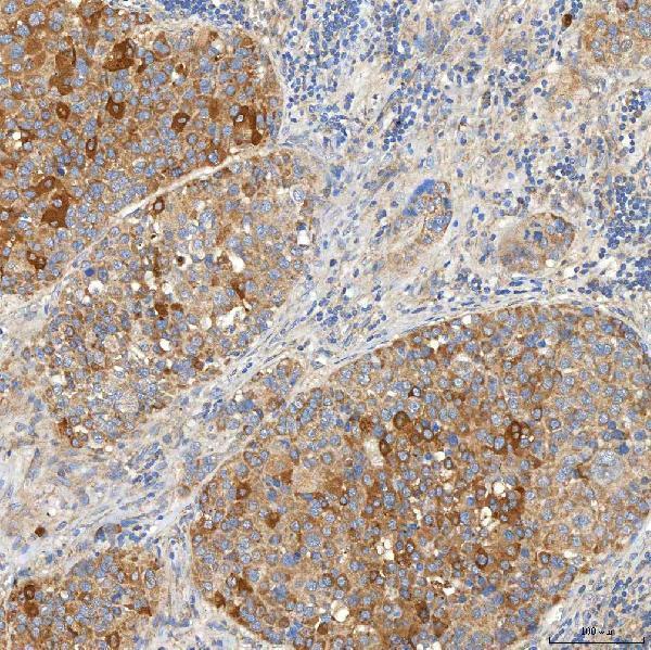 a08882 1 snph primary antibodies ihc testing 5