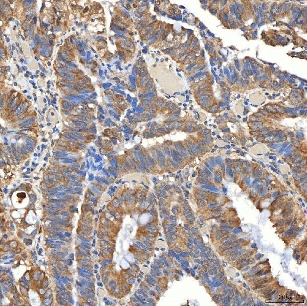 a08882 1 snph primary antibodies ihc testing 8
