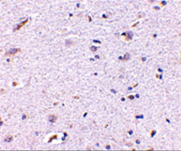 Immunohistochemistry of Syntaphilin in human brain with Syntaphilin antibody at 5 μg/mL