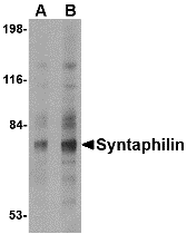 Western blot analysis of Syntaphilin in human brain tissue lysate with Syntaphilin antibody at (A) 2 and (B) 4 μg/mL