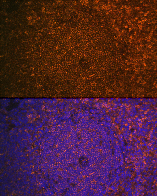 Immunofluorescence analysis of Mouse spleen using CST7 antibody  at dilution of 1:100